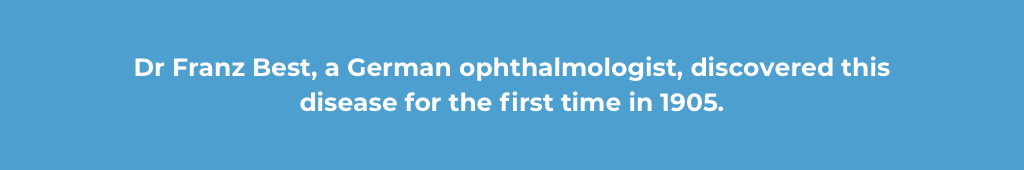 second most common type of juvenile macular degeneration best disease 3