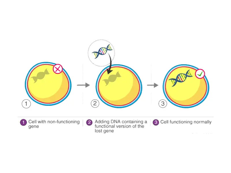 Treatment Option for Retinitis Pigmentosa