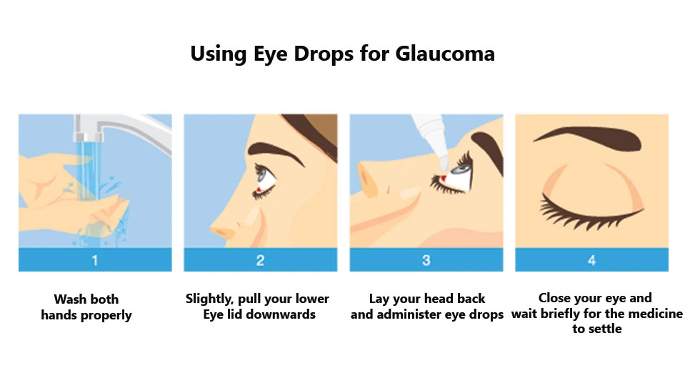 eye drops for glaucoma image