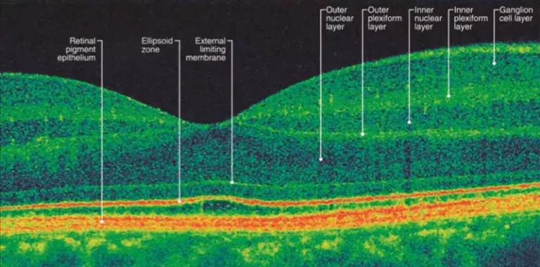 what eye examination 66daae4832f81